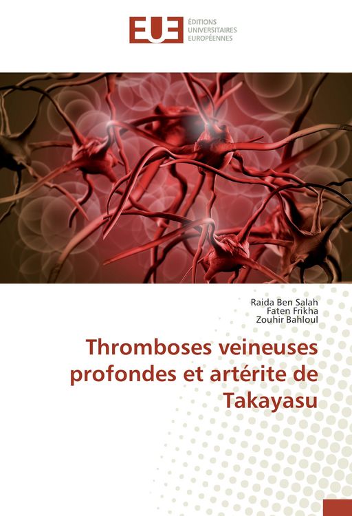 Produktbild: Thromboses veineuses profondes et art&eacute;rite de Takayasu