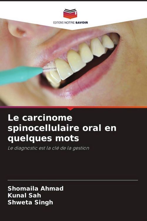 Produktbild: Le carcinome spinocellulaire oral en quelques mots