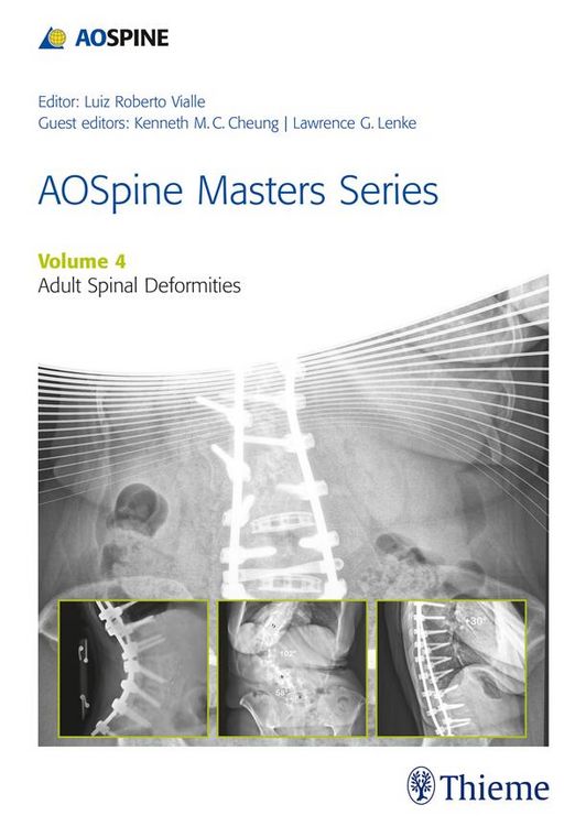 Produktbild: AOSpine Masters Series, Volume 4: Adult Spinal Deformities