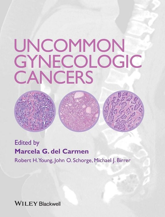 Produktbild: Uncommon Gynecologic Cancers