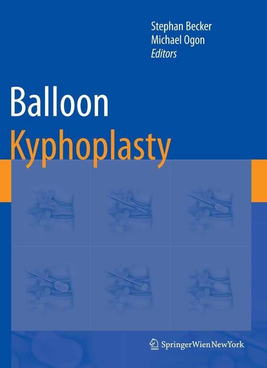 Produktbild: Balloon Kyphoplasty