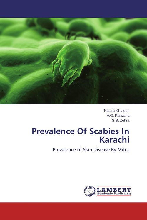 Produktbild: Prevalence Of Scabies In Karachi