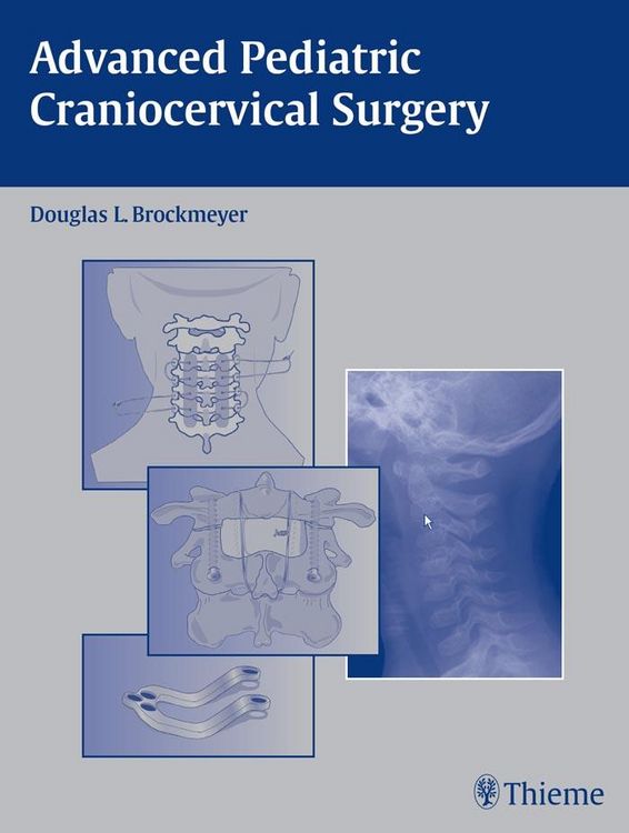 Produktbild: Advanced Pediatric Craniocervical Surgery