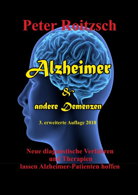 Produktbild: Alzheimer & andere Demenzen