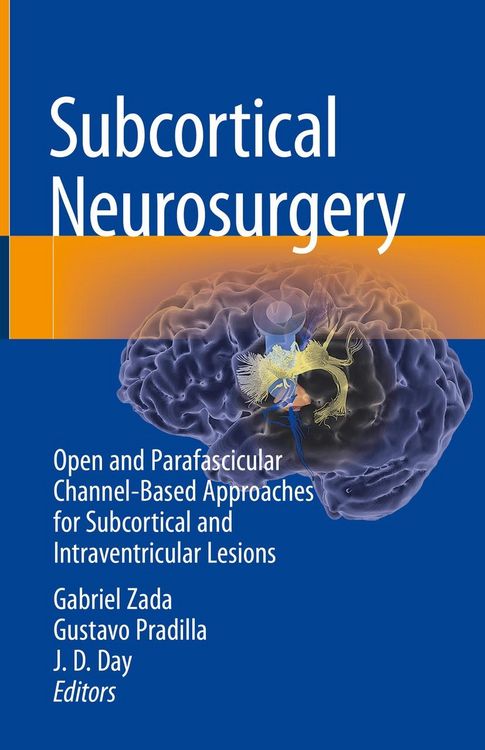 Produktbild: Subcortical Neurosurgery