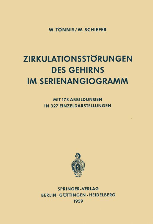 Produktbild: Zirkulationsst&ouml;rungen des Gehirns im Serienangiogramm