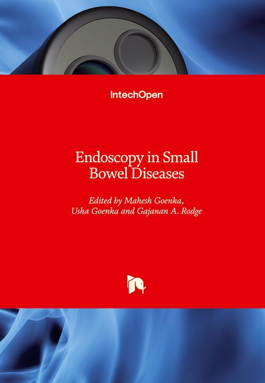 Produktbild: Endoscopy in Small Bowel Diseases