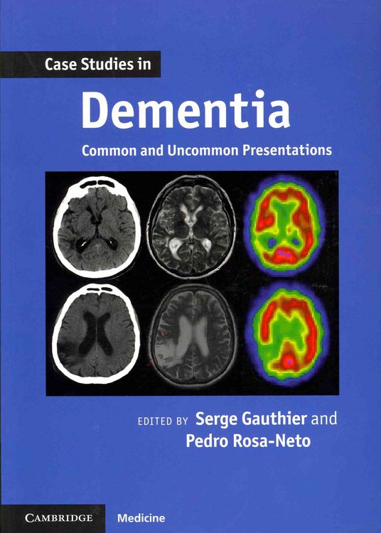 Produktbild: Case Studies in Dementia