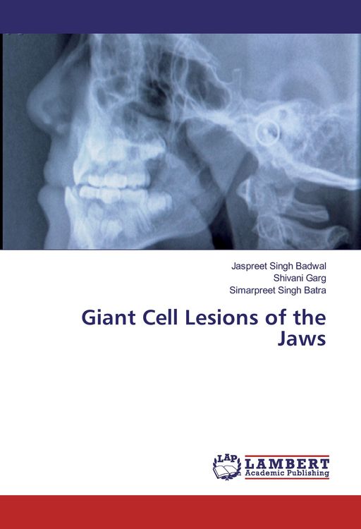 Produktbild: Giant Cell Lesions of the Jaws