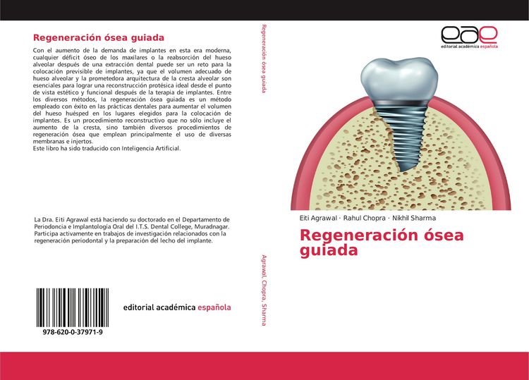 Produktbild: Regeneraci&oacute;n &oacute;sea guiada