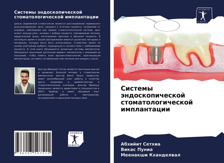 Produktbild: Sistemy &auml;ndoskopicheskoj stomatologicheskoj implantacii