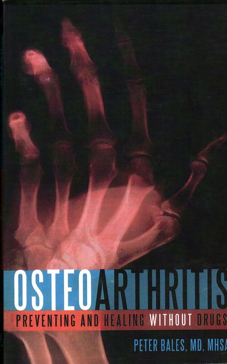 Produktbild: Osteoarthritis