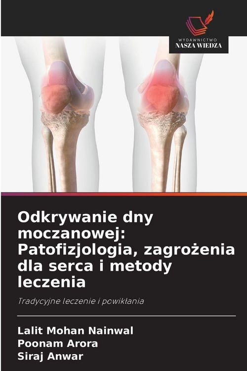 Produktbild: Odkrywanie dny moczanowej: Patofizjologia, zagro&iquest;enia dla serca i metody leczenia