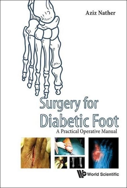 Produktbild: Surgery for Diabetic Foot