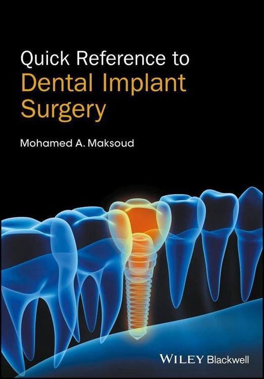 Produktbild: Quick Reference to Dental Implant Surgery