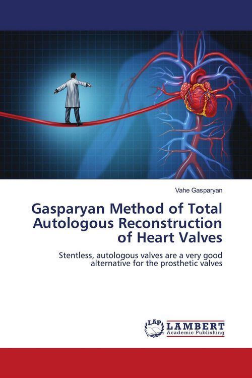 Produktbild: Gasparyan Method of Total Autologous Reconstruction of Heart Valves
