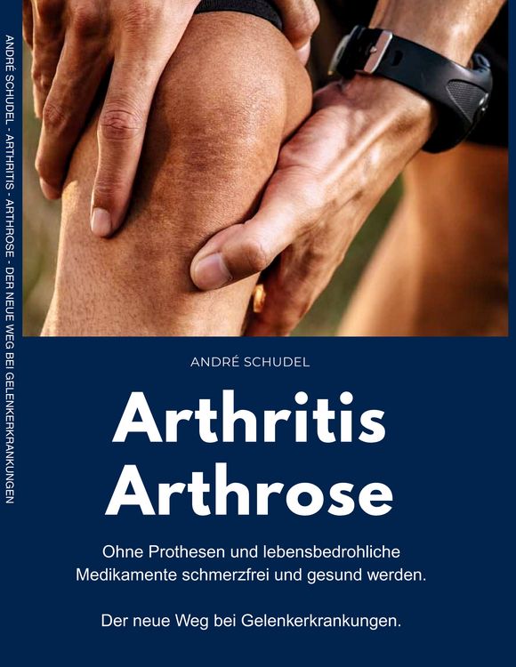 Produktbild: Arthritis - Arthrose. Ohne Prothesen und lebensbedrohliche Medikamente schmerzfrei und gesund werden. Der neue Weg bei Gelenkerkrankungen: Was hilft konkret bei Arthritis und/oder Arthrose?