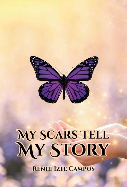 Produktbild: My Scars Tell My Story