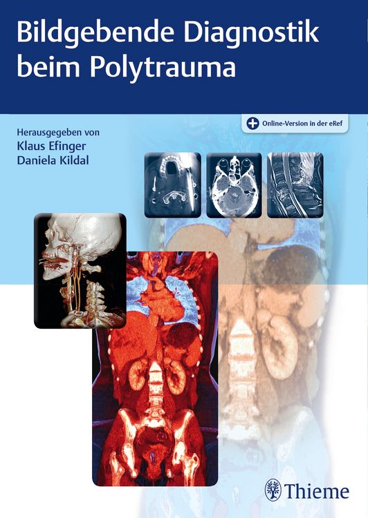Produktbild: Bildgebende Diagnostik beim Polytrauma