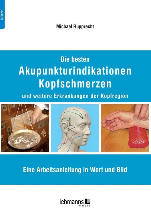 Produktbild: Die besten Akupunkturindikationen Kopfschmerzen und weitere Erkrankungen der Kopfregion