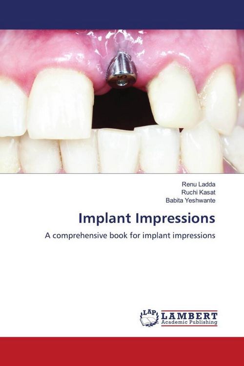Produktbild: Implant Impressions