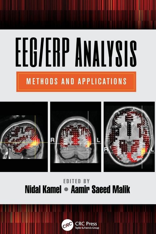 Produktbild: EEG/ERP Analysis