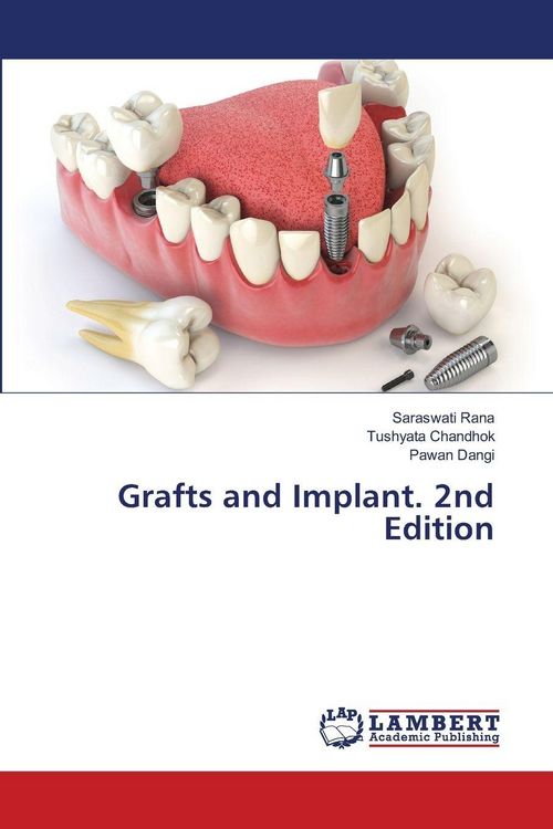 Produktbild: Grafts and Implant. 2nd Edition