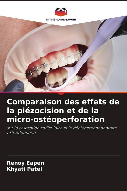 Produktbild: Comparaison des effets de la pi&eacute;zocision et de la micro-ost&eacute;operforation
