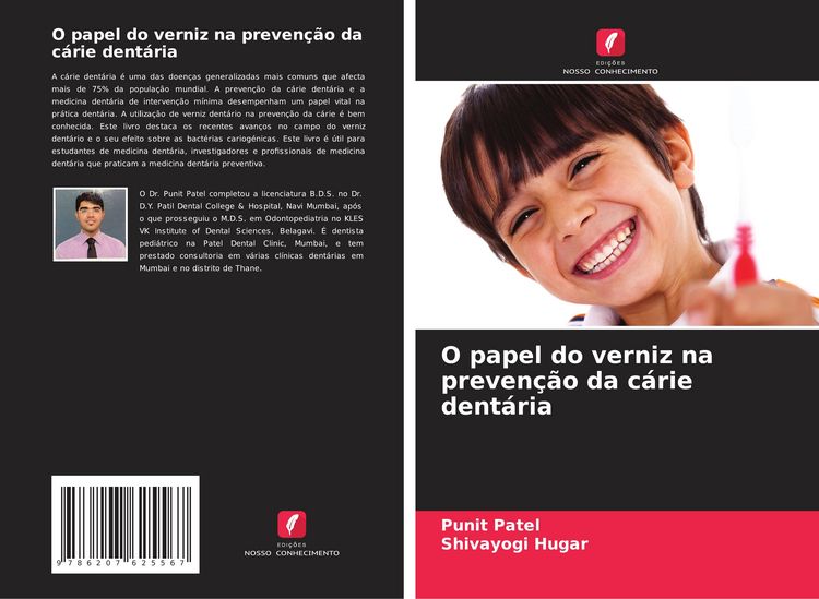 Produktbild: O papel do verniz na preven&ccedil;&atilde;o da c&aacute;rie dent&aacute;ria