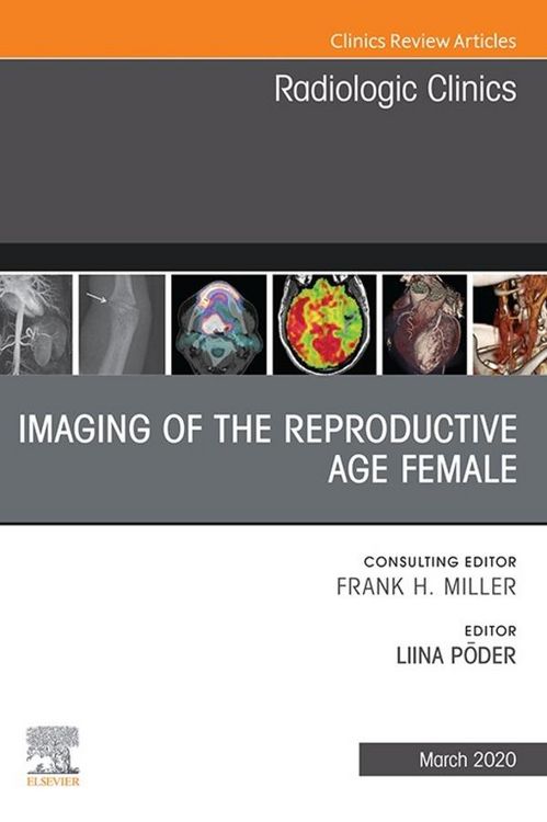 Produktbild: Imaging of the Reproductive Age Female,An Issue of Radiologic Clinics of North America