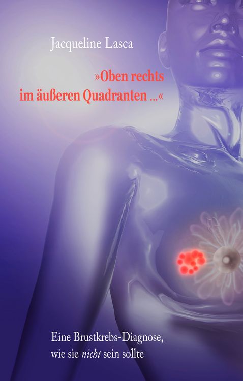 Produktbild: Oben rechts im &auml;u&szlig;eren Quadranten ...