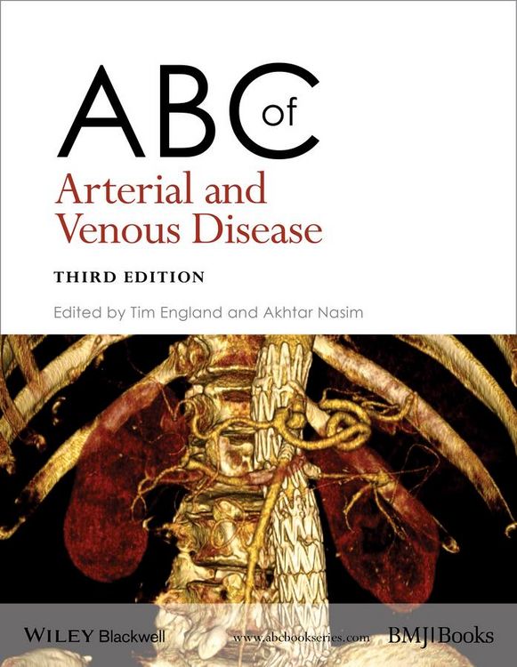 Produktbild: ABC of Arterial and Venous Disease