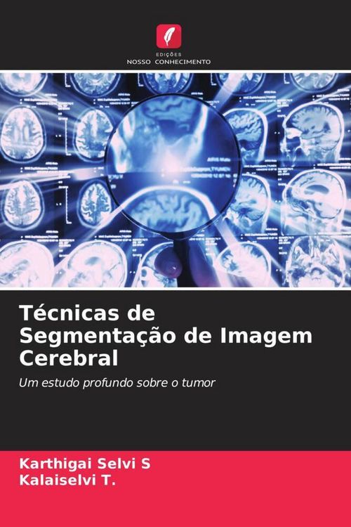 Produktbild: T&eacute;cnicas de Segmenta&ccedil;&atilde;o de Imagem Cerebral