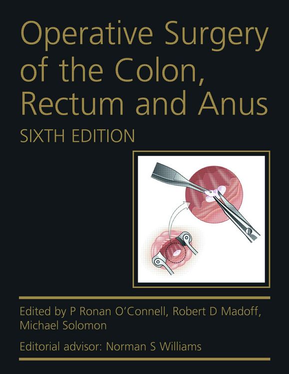 Produktbild: Operative Surgery of the Colon, Rectum and Anus