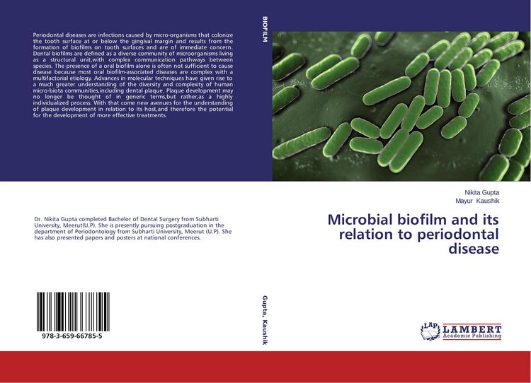 Produktbild: Microbial biofilm and its relation to periodontal disease