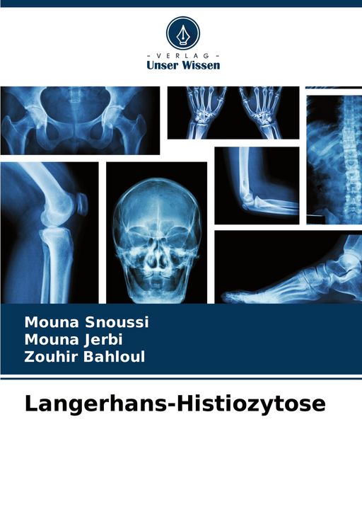 Produktbild: Langerhans-Histiozytose