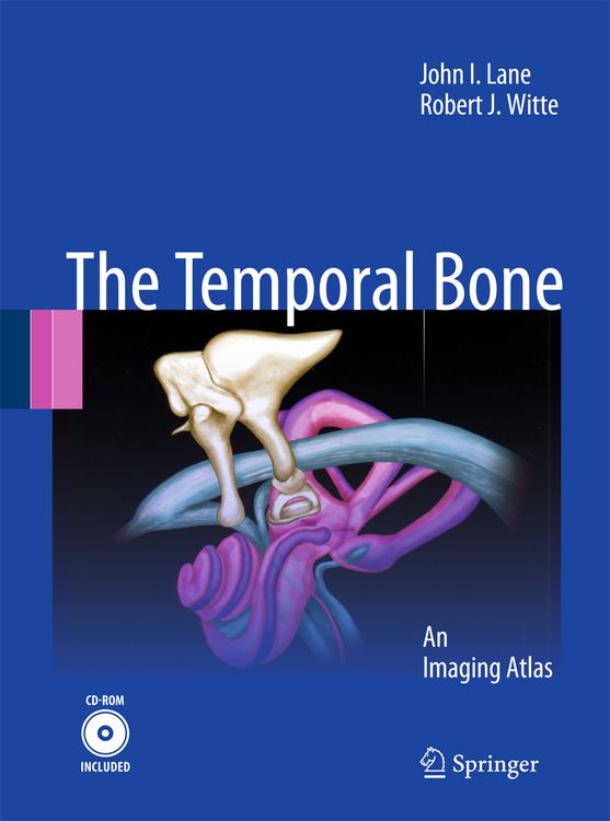 Produktbild: Temporal Bone