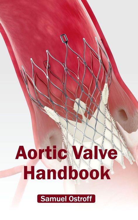 Produktbild: Aortic Valve Handbook