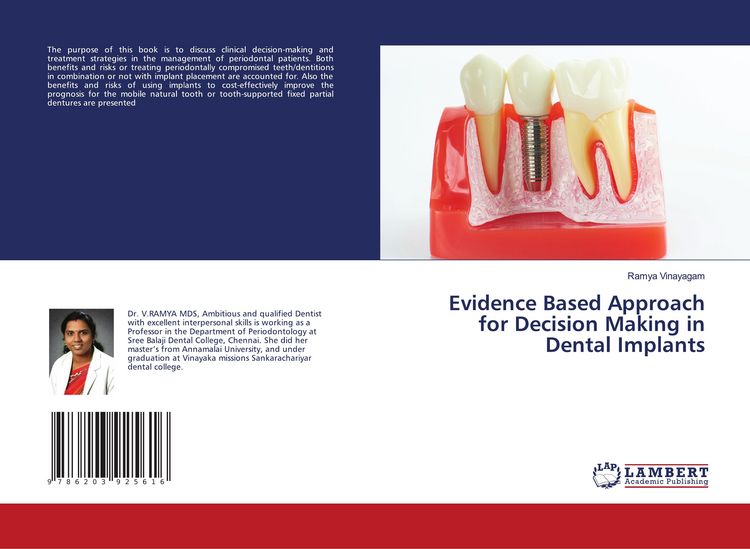 Produktbild: Evidence Based Approach for Decision Making in Dental Implants