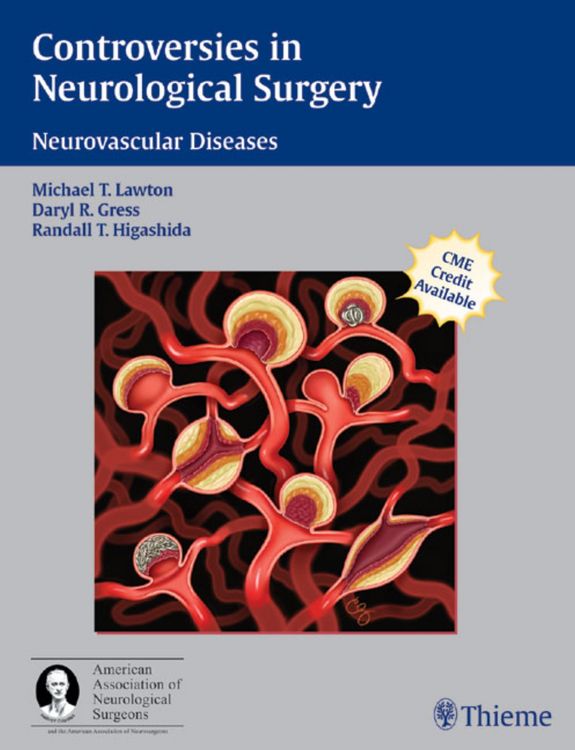 Produktbild: Controversies in Neurological Surgery