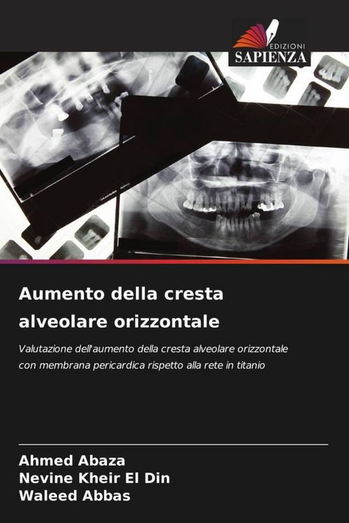 Produktbild: Aumento della cresta alveolare orizzontale