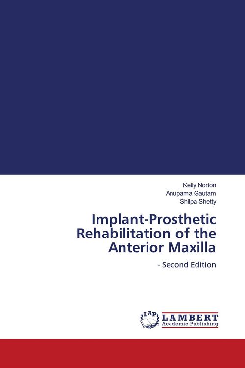 Produktbild: Implant-Prosthetic Rehabilitation of the Anterior Maxilla