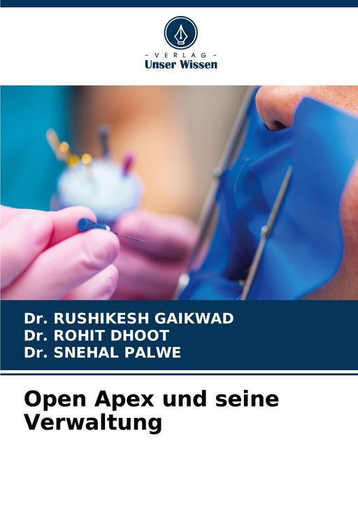 Produktbild: Open Apex und seine Verwaltung