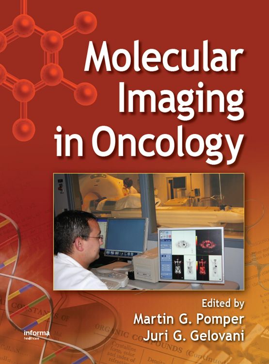 Produktbild: Molecular Imaging in Oncology