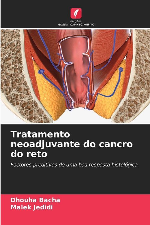 Produktbild: Tratamento neoadjuvante do cancro do reto