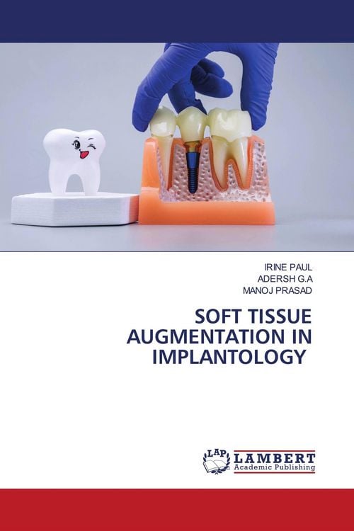 Produktbild: SOFT TISSUE AUGMENTATION IN IMPLANTOLOGY