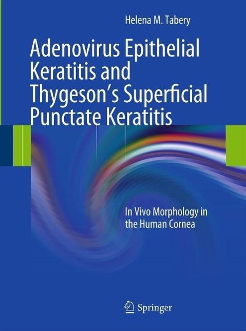 Produktbild: Adenovirus Epithelial Keratitis and Thygeson's Superficial Punctate Keratitis