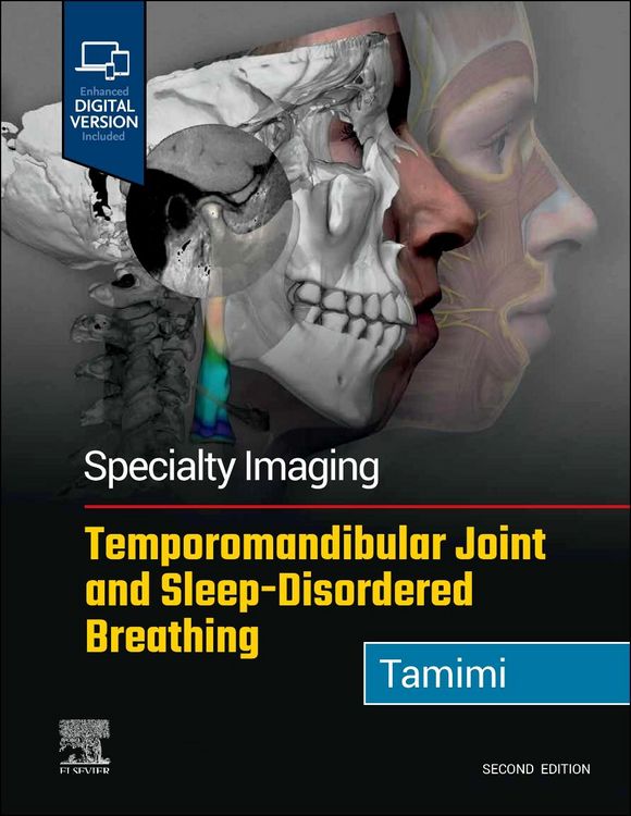 Produktbild: Specialty Imaging: Temporomandibular Joint and Sleep-Disordered Breathing