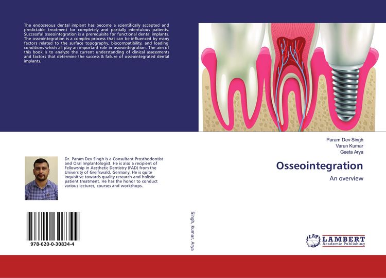Produktbild: Osseointegration