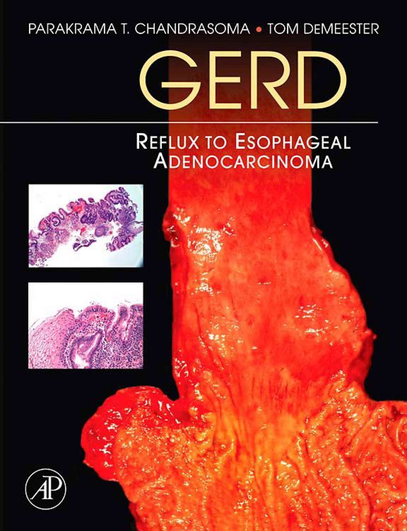 Produktbild: Gerd
